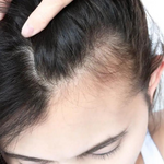 Load image into Gallery viewer, Hair Loss Treatment First Trial
